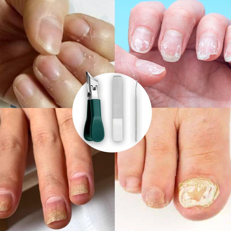 3PCS Slanted Nail Clipper Set-Clean & Effortless Cutting